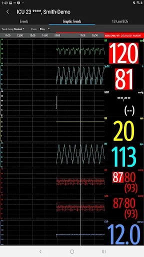 I-download ang Mindray Mobile Viewer – Real-time Monitoring App - Screenshot 15