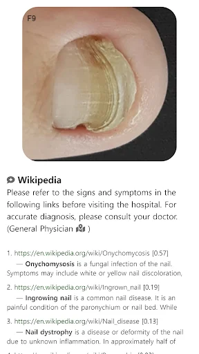 I-download ang Model Dermatol – Skin Disease App: Libreng Skin Atlas - Screenshot 14