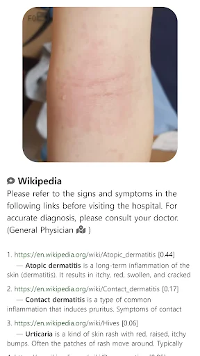 I-download ang Model Dermatol – Skin Disease App: Libreng Skin Atlas - Screenshot 13