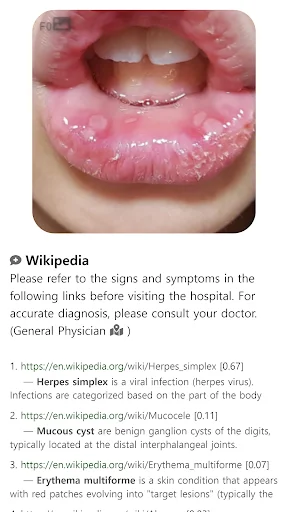 I-download ang Model Dermatol – Skin Disease App: Libreng Skin Atlas - Screenshot 15