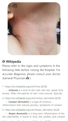I-download ang Model Dermatol – Skin Disease App: Libreng Skin Atlas - Screenshot 12
