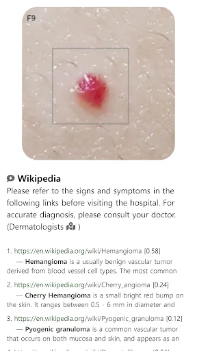 I-download ang Model Dermatol – Skin Disease App: Libreng Skin Atlas - Screenshot 11