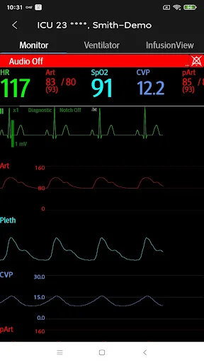 I-download ang Mindray Mobile Viewer – Real-time Monitoring App - Screenshot 3