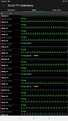 I-download ang Mindray Mobile Viewer – Real-time Monitoring App - Screenshot 22