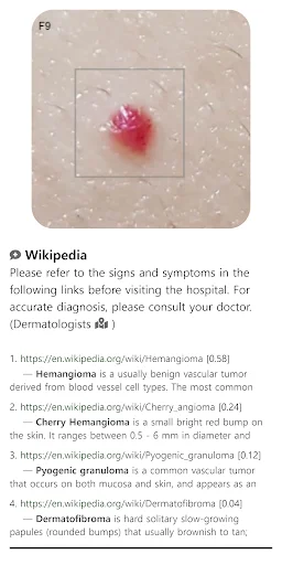 I-download ang Model Dermatol – Skin Disease App: Libreng Skin Atlas - Screenshot 5