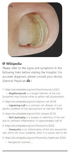 I-download ang Model Dermatol – Skin Disease App: Libreng Skin Atlas - Screenshot 1