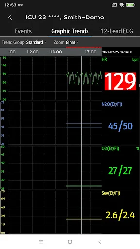 I-download ang Mindray Mobile Viewer – Real-time Monitoring App - Screenshot 7