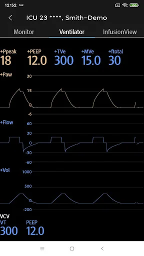 I-download ang Mindray Mobile Viewer – Real-time Monitoring App - Screenshot 4