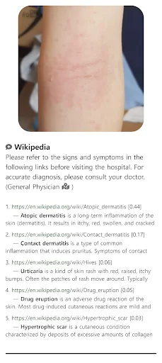 I-download ang Model Dermatol – Skin Disease App: Libreng Skin Atlas - Screenshot 7