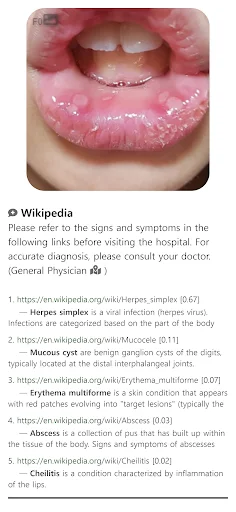 I-download ang Model Dermatol – Skin Disease App: Libreng Skin Atlas - Screenshot 8