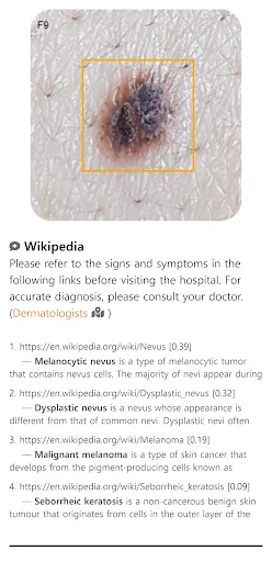 I-download ang Model Dermatol – Skin Disease App: Libreng Skin Atlas - Screenshot 3