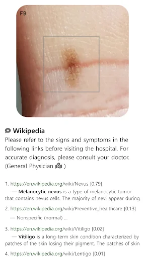 I-download ang Model Dermatol – Skin Disease App: Libreng Skin Atlas - Screenshot 10