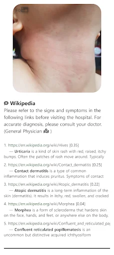I-download ang Model Dermatol – Skin Disease App: Libreng Skin Atlas - Screenshot 6