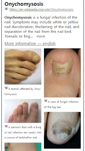 I-download ang Model Dermatol – Skin Disease App: Libreng Skin Atlas - Screenshot 2