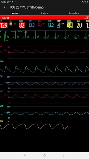 I-download ang Mindray Mobile Viewer – Real-time Monitoring App - Screenshot 11
