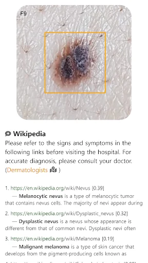 I-download ang Model Dermatol – Skin Disease App: Libreng Skin Atlas - Screenshot 9