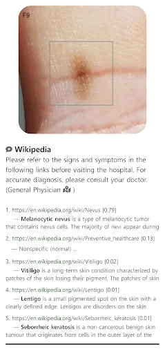 I-download ang Model Dermatol – Skin Disease App: Libreng Skin Atlas - Screenshot 4